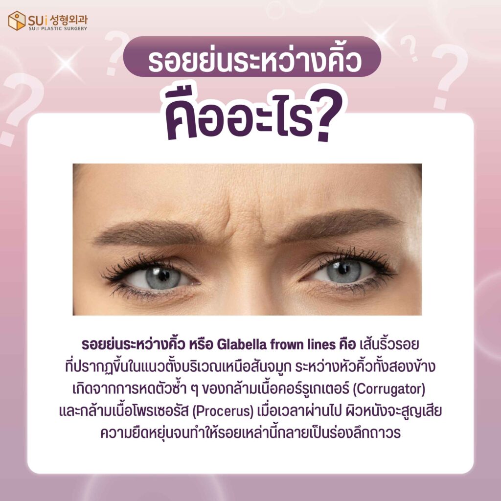 รอยย่นระหว่างคิ้ว คืออะไร