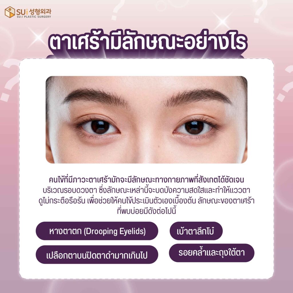 ลักษณะ ตาเศร้า